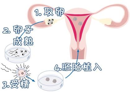 42岁成功案例